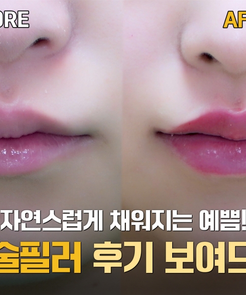 유튜브이미지